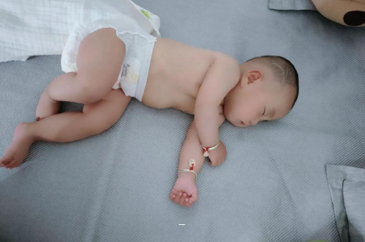 瑞安孕妇前庭大腺囊肿